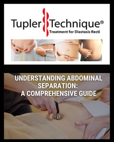 Understanding Stomach/Abdominal Separation: A Comprehensive Guide