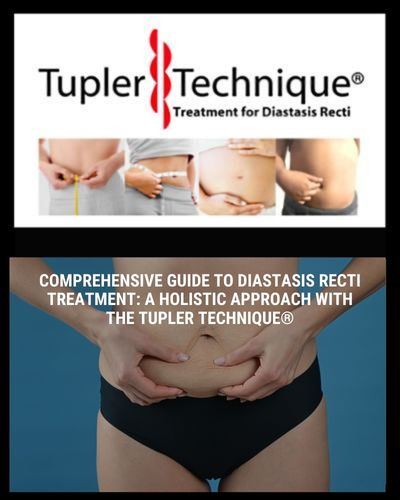 Comprehensive Guide to Diastasis Recti Treatment: A Holistic Approach with the Tupler Technique®