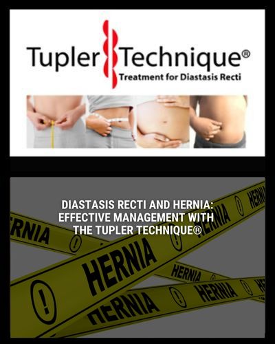Diastasis Recti and Hernia: Effective Management with the Tupler Technique®