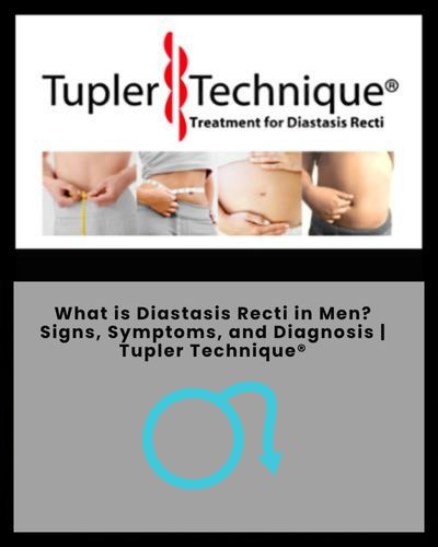 What is Diastasis Recti in Men? Signs, Symptoms, and Diagnosis | Tupler Technique®