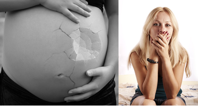 Discover the Post Pregnancy Tummy Problem That Almost Nobody Tells Women About-diastasisrehab