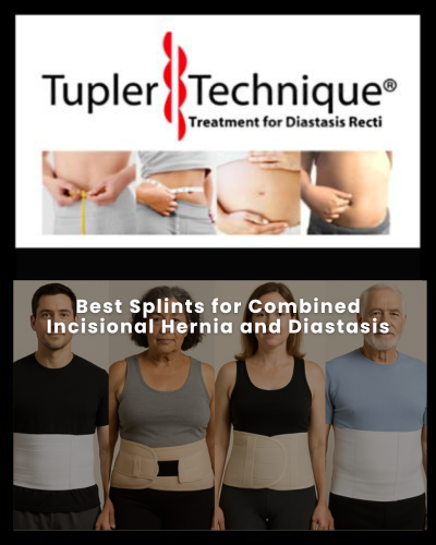 Best Splints for Combined Incisional Hernia and Diastasis
