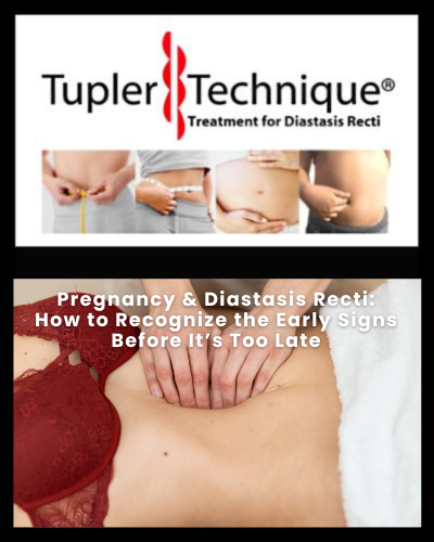 Pregnancy & Diastasis Recti: How to Recognize the Early Signs Before It’s Too Late