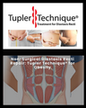 Non-Surgical Diastasis Recti Repair: Tupler Technique® for Obesity