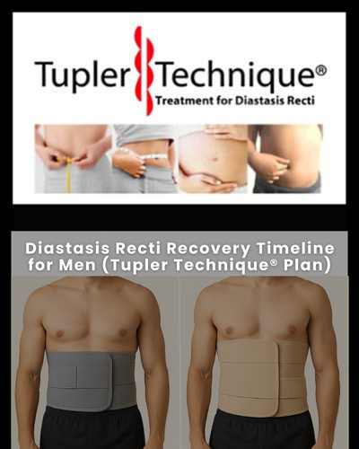 Diastasis Recti Recovery Timeline for Men (Tupler Technique® Plan)