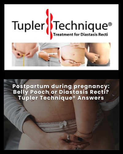 Postpartum during pregnancy: Belly Pooch or Diastasis Recti? Tupler Technique® Answers