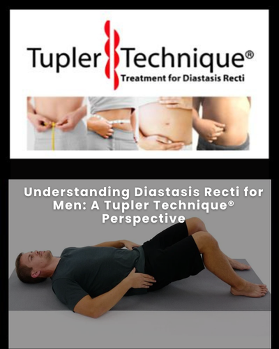 Understanding Diastasis Recti for Men: A Tupler Technique® Perspective
