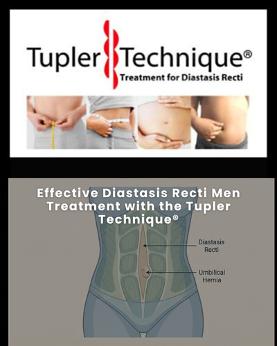 Effective Diastasis Recti Men Treatment with the Tupler Technique®