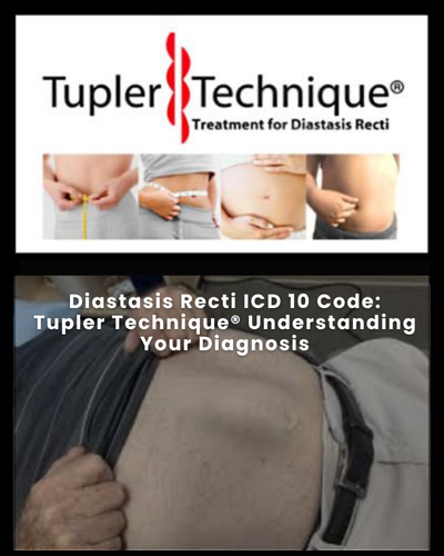 Diastasis Recti ICD 10 Code: Tupler Technique® Understanding Your Diagnosis