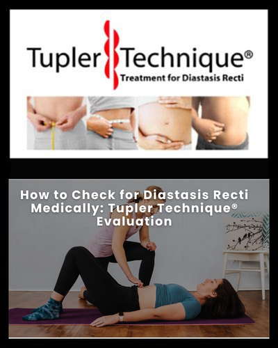 How to Check for Diastasis Recti Medically: Tupler Technique® Evaluation