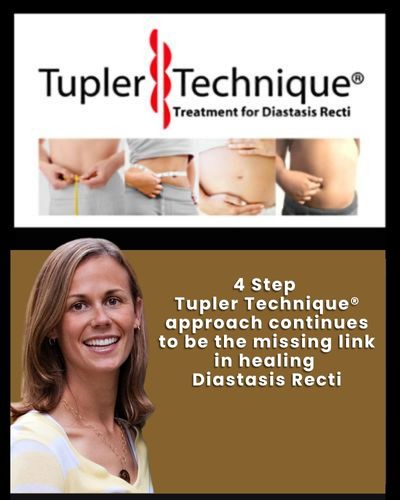 Discover the Missing Link to Healing Diastasis Recti with the Tupler Technique