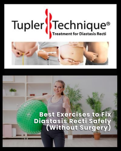 Best Exercises to Fix Diastasis Recti Safely (Without Surgery)