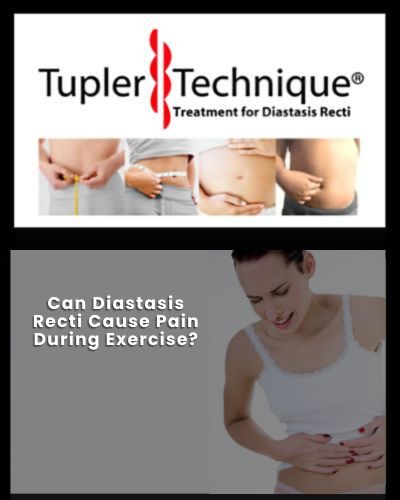 Can Diastasis Recti Cause Pain During Exercise - Diastasis Rehab