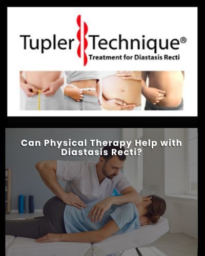 Can Physical Therapy Help with Diastasis Recti?