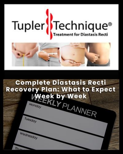 Complete Diastasis Recti Recovery Plan: What to Expect Week by Week