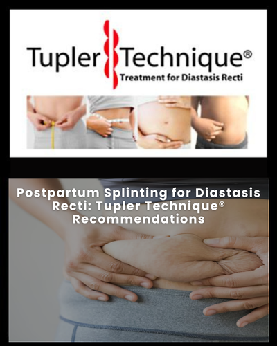 Postpartum Splinting for Diastasis Recti: Tupler Technique® Recommendations