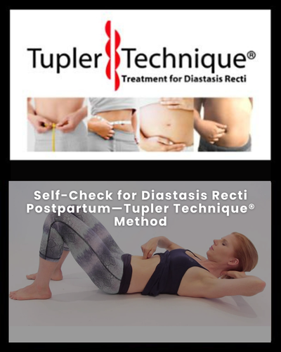 Self Check for diastasis recti postpartum - Tupler technique method