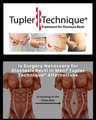 Is Surgery Necessary for Diastasis Recti in Men? Tupler Technique® Alternatives