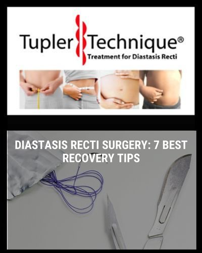 Diastasis Recti Surgery: 7 Best Recovery Tips