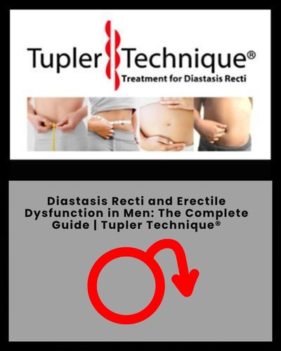 Diastasis Recti and Erectile Dysfunction in Men: Complete Guide Tupler technique