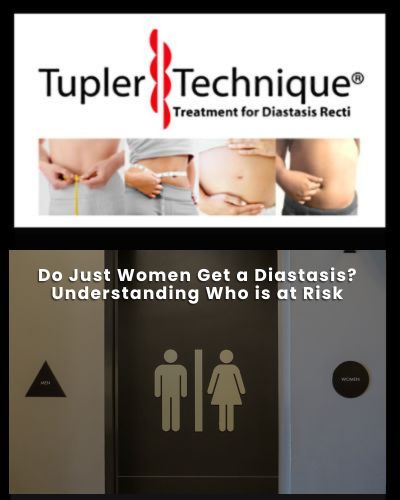 Do Just Women Get a Diastasis? Understanding Who is at Risk