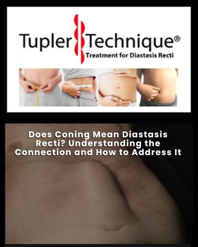 Does Coning Mean Diastasis Recti - Diastasis Rehab