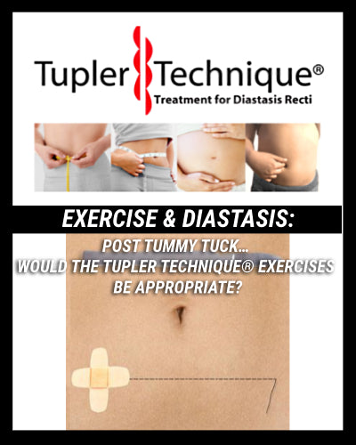 Enhancing Your Tummy Tuck Results with Tupler Technique® Exercises: What You Need to Know