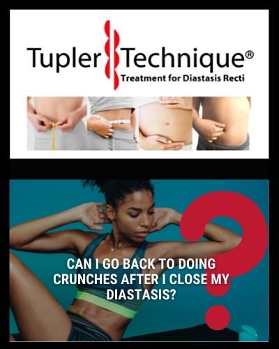 Can I go back to doing crunches after I close my diastasis?