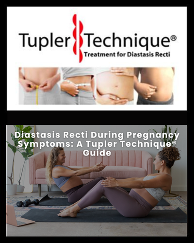 Diastasis Recti During Pregnancy Symptoms: A Tupler Technique® Guide