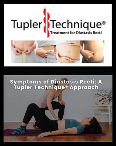 Symptoms of Diastasis Recti: A Tupler Technique® Approach