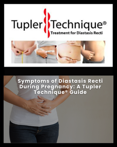 Symptoms of Diastasis Recti During Pregnancy: A Tupler Technique® Guide