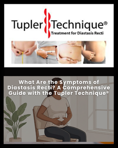 What Are the Symptoms of Diastasis Recti? A Comprehensive Guide with the Tupler Technique®
