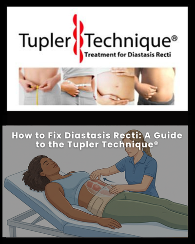 How to Fix Diastasis Recti: A Guide to the Tupler Technique®