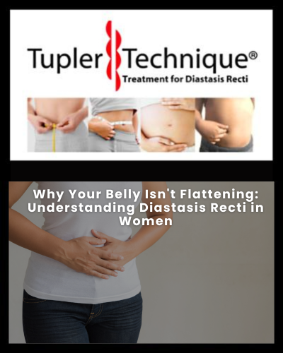 Why Your Belly Isn't Flattening: Understanding Diastasis Recti in Women