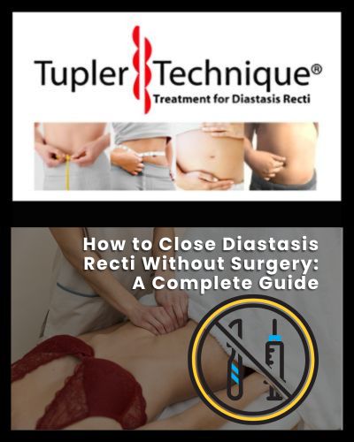 How to Close Diastasis Recti Without Surgery: A Complete Guide
