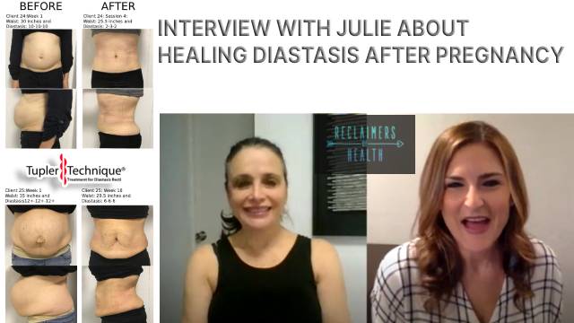 INTERVIEW WITH JULIE ABOUT HEALING DIASTASIS AFTER PREGNANCY-diastasisrehab