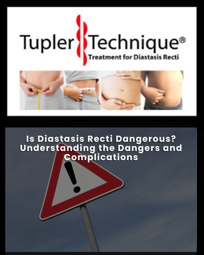 Understanding the Dangers and Complications - Diastasis Rehab
