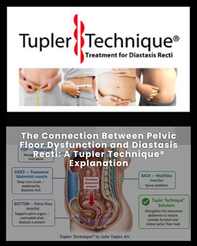 The Connection Between Pelvic Floor Dysfunction and Diastasis Recti: A Tupler Technique® Explanation
