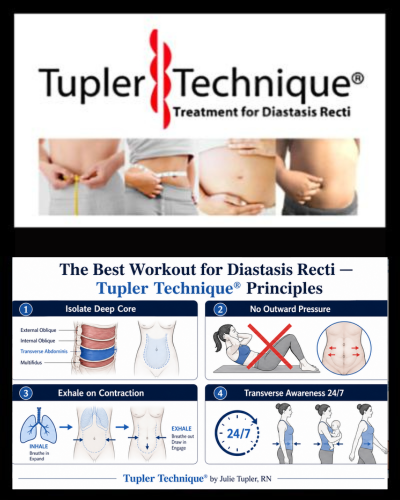 The Best Workout for Diastasis Recti: Tupler Technique® Principles