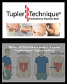 What is Diastasis Recti: Tupler Technique® Explanation