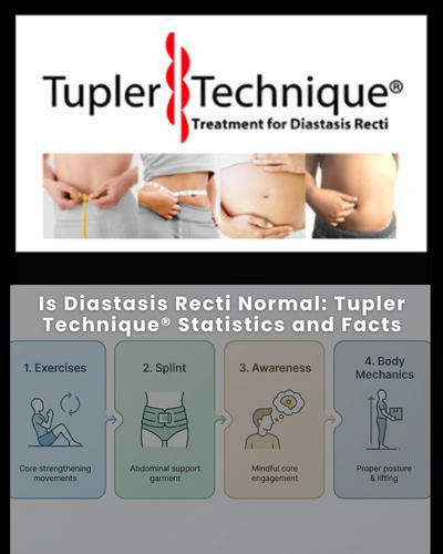 Is Diastasis Recti Normal: Tupler Technique® Statistics and Facts