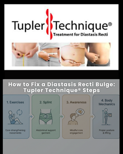 How to Fix a Diastasis Recti Bulge: Tupler Technique® Steps