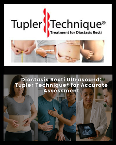 Diastasis Recti Ultrasound: Tupler Technique® for Accurate Assessment