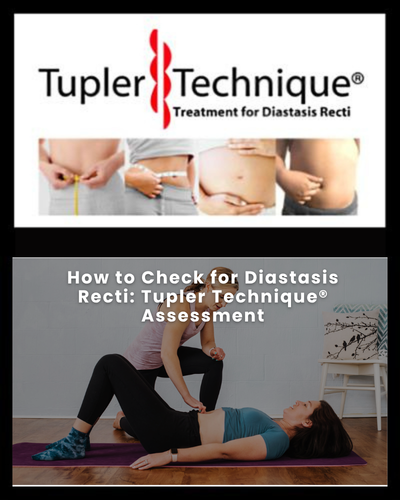 How to Check for Diastasis Recti: Tupler Technique® Assessment