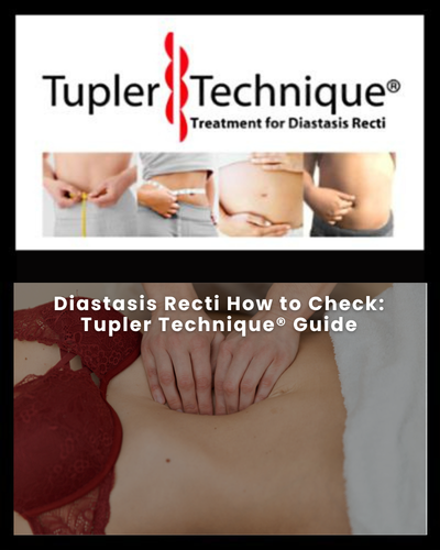 Diastasis Recti How to Check: Tupler Technique® Guide