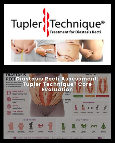 Diastasis Recti Assessment: Tupler Technique® Core Evaluation