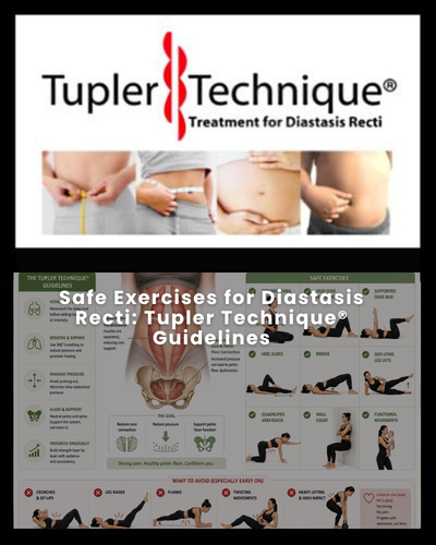 Safe Exercises for Diastasis Recti: Tupler Technique® Guidelines