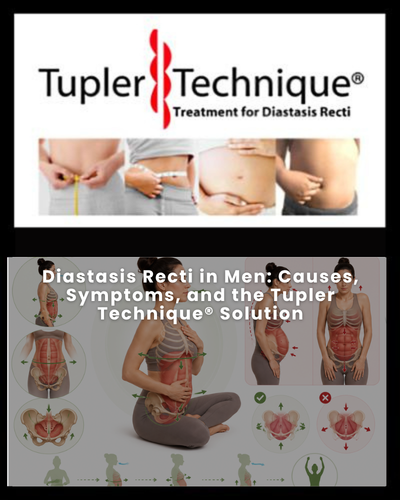 Diastasis Recti in Men: Causes, Symptoms, and the Tupler Technique® Solution