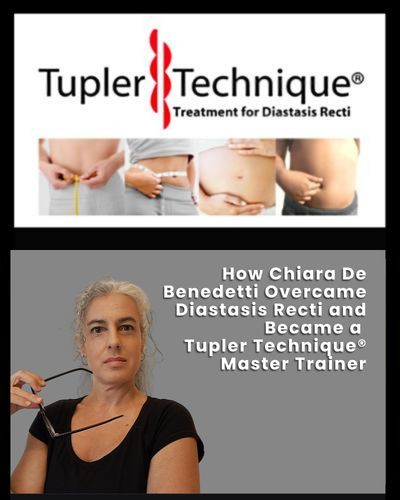 How Chiara De Benedetti Overcame Diastasis Recti and Became a Tupler Technique Master Trainer - Diastasis Rehab