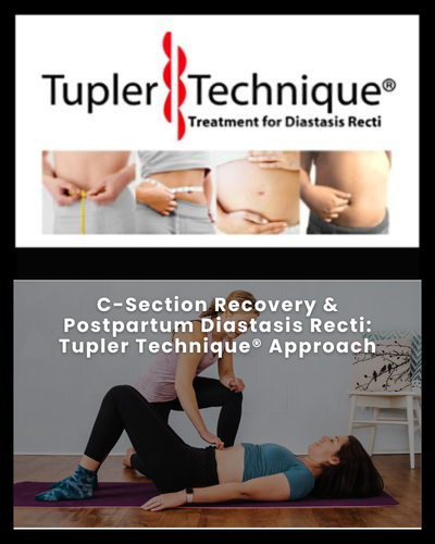 C-Section Recovery & Postpartum Diastasis Recti - Diastasis Rehab